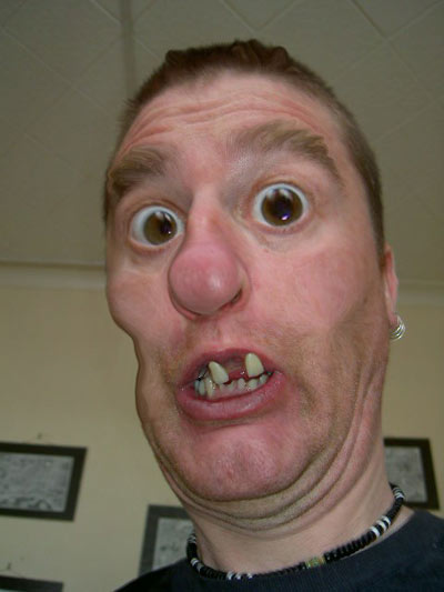 gurn 1
